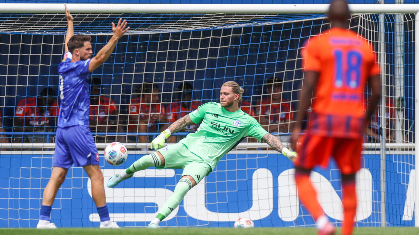 Loris Karius beim Test gegen Twente